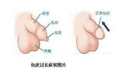 1601260476526149.jpg 85254.jpg